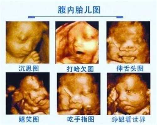 成都代孕：孕期一旦出现这些症状，胎儿可能有