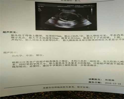 陕西代孕机构：孕妇产前一定要做唐氏筛查吗？
