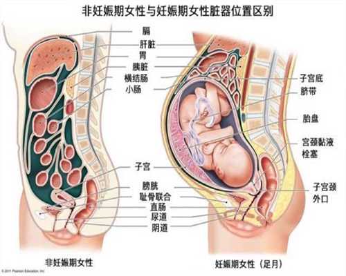 宿迁代孕好孕：孕妇能用花露水吗看仔细 别把孕