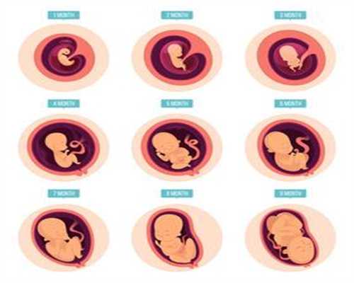 滨州代孕产子中介：孕早期吃什么吐什么该怎么