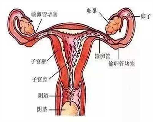 成都代孕卵子是谁的,女性身体出现这种状况，短