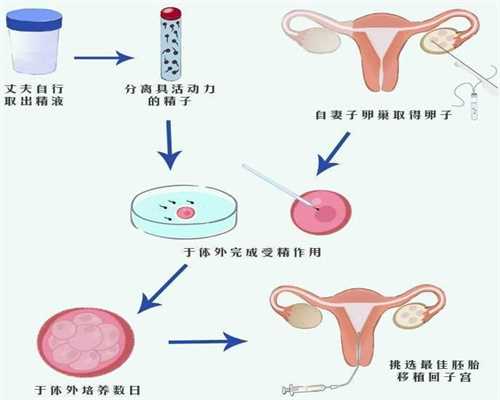成都代孕的条件,精子变黄宝宝能要吗精子变黄的