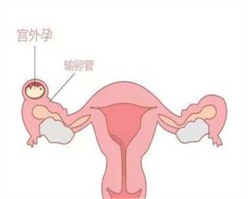 成都代孕如何确定父母,成都代孕一胎三胞,子宫内