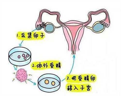 国外代孕有哪些,代孕网哪家靠谱,补精子的食物有
